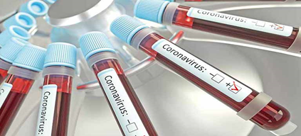 coronavirus-anticorpos-0505